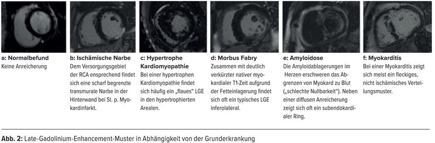 Kardiale ihre Stärken und Schwächen